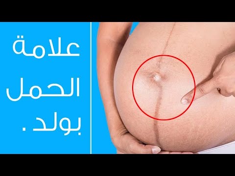 شكل سرة الحامل بولد , علامات غريبة تظهر للست الى في بطنها ذكر