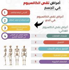 اسباب نقص الكالسيوم , اعراض وعلاج نقص الكالسيوم