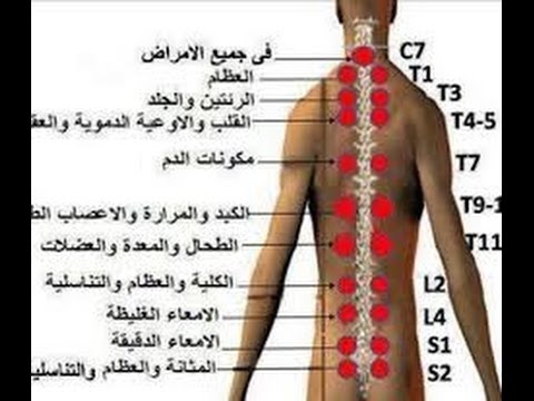 فوائد الحجامة الجافة , الطب البديل والعلاج بطرق طبيه قديمة