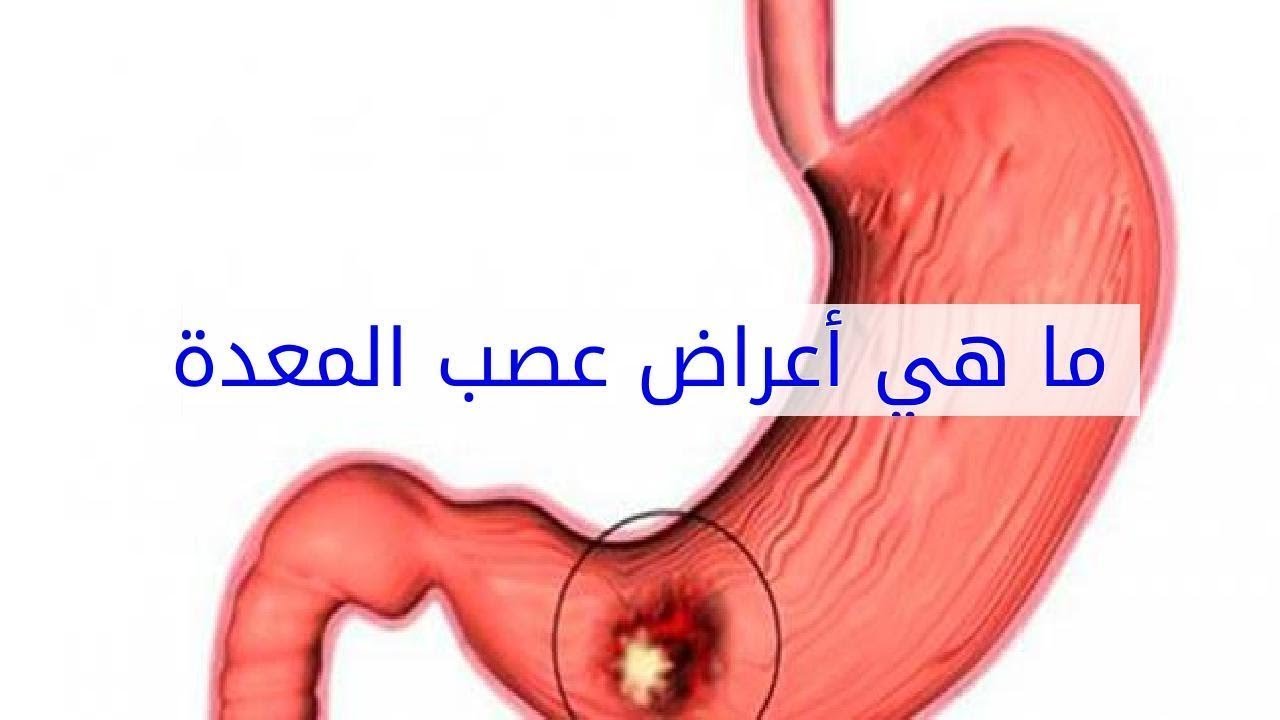 تعانى اوى بجد , اعراض عصب المعدة