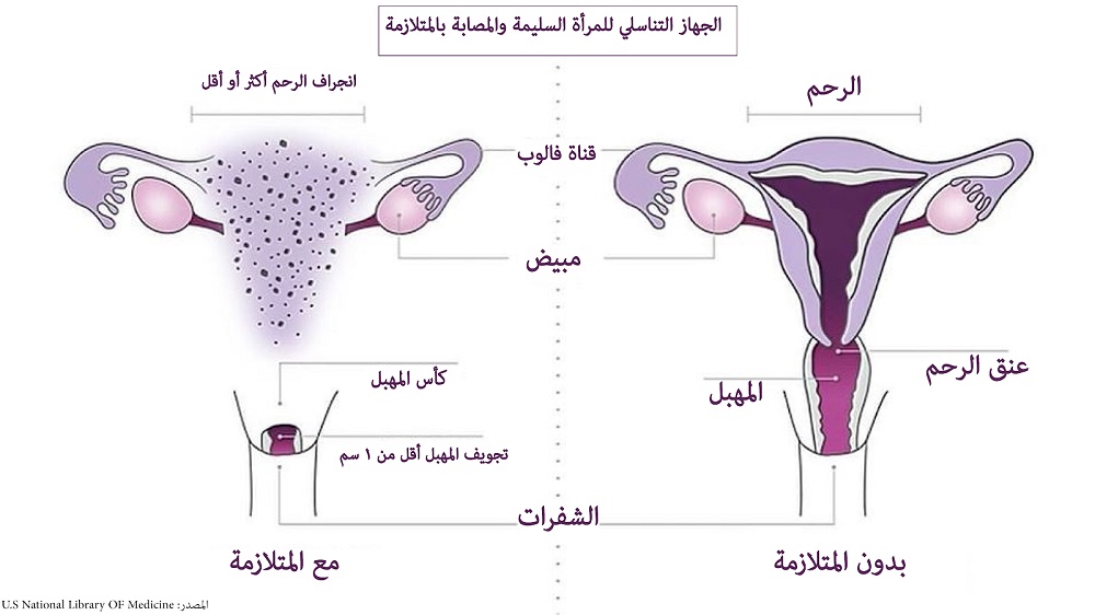 مكان المهبل بالضبط , الجهاز التناسلى , 