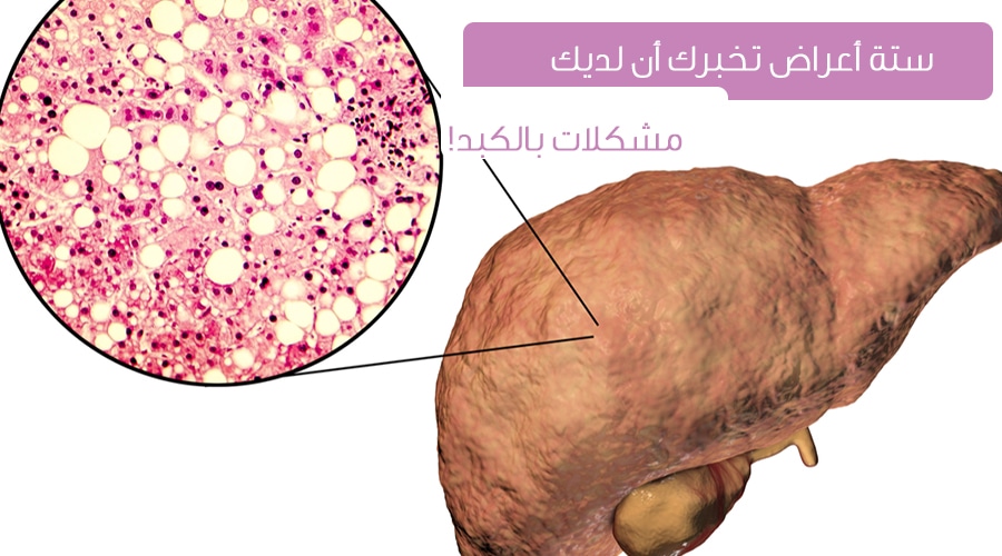 اعراض مشاكل الكبد , من المشاكل الشائعه